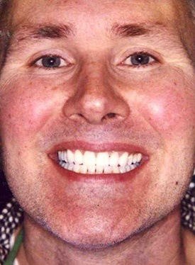 Man smiling happily after treatment