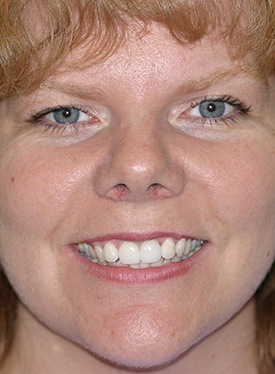 Woman sharing beautiful white smile