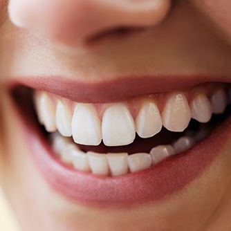 Closeup of beautiful smile