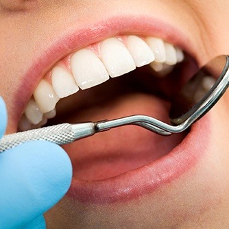 Closeup of smile during dental exam