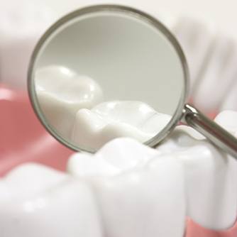 Closeup of teeth with dental sealants