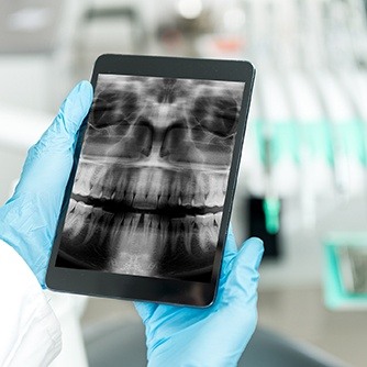 Digital x-rays on tablet computer