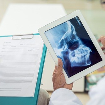 X-ray of jaw and skull
