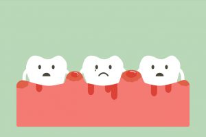 : In this post, learn the facts you need to know about gum disease from your dentist in Farmington. 