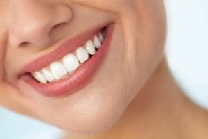 Woman smiling showing straight, white teeth